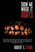 Cover Image for Show Me Where It Hurts -- Robert E. Stahl, Paperback